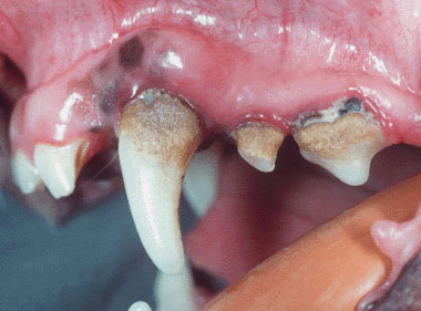 dental_calculus.jpg